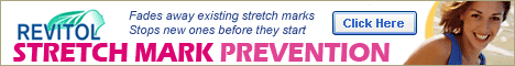 Pencegahan Stretch Mark