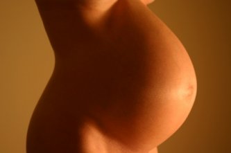 Pregnancy and dieting after being overweight are common causes of stretch marks